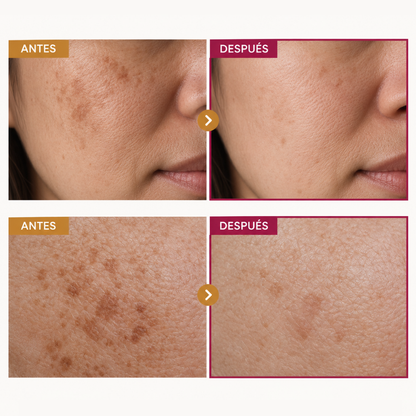 Zabyro Tersia — Crema Antimanchas Coreana